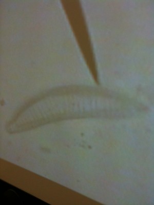 Microorgansism at 400X Magnification